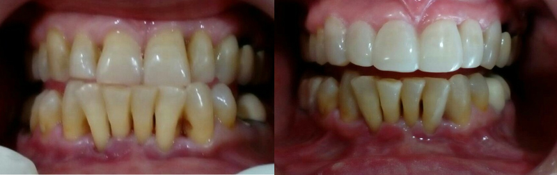 Cosmetic Dentistry 3